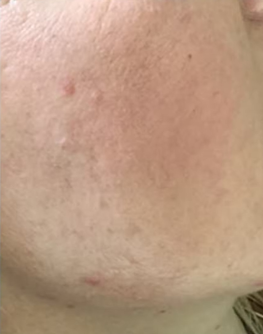 PRX B&A 2